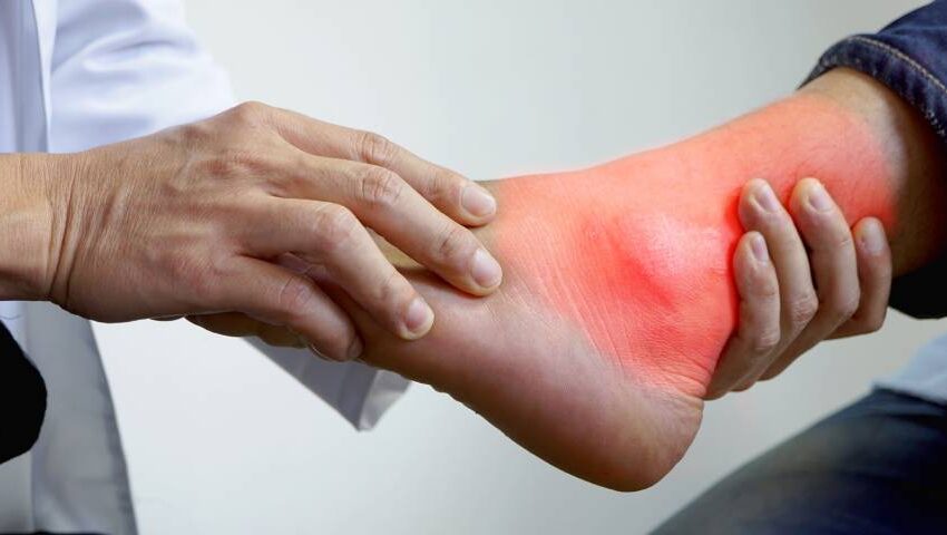 How to prevent Hyperuricaemia and Gout Arthritis? | Ortho Patna