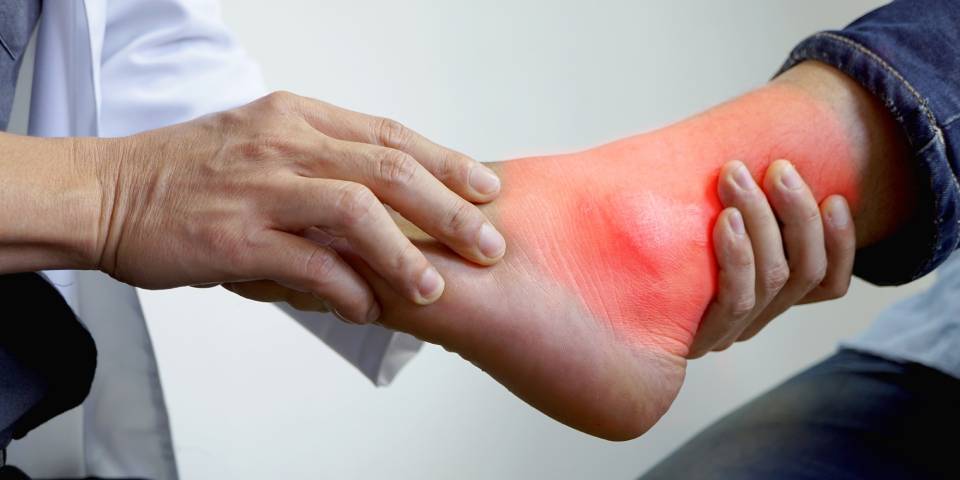 How to prevent Hyperuricaemia and Gout Arthritis? | Ortho Patna