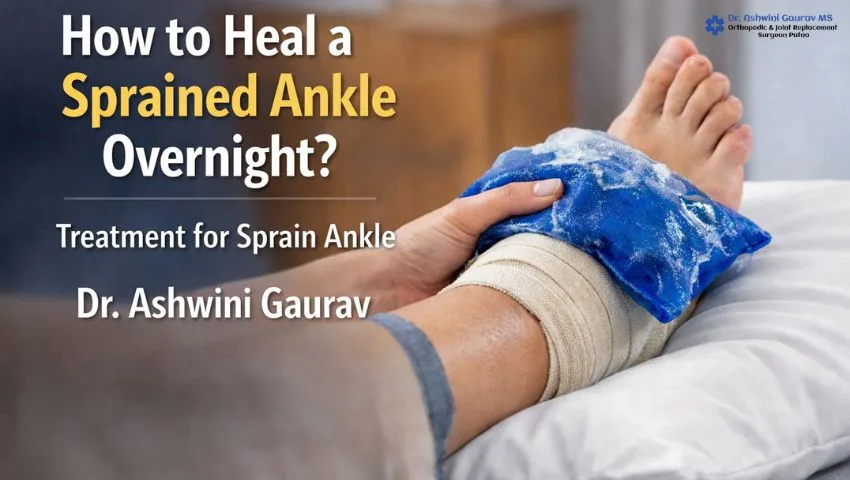 How to Heal a Sprained Ankle Overnight with ice therapy and bandage – treatment for sprain ankle to reduce swelling and improve ankle twist recovery time.