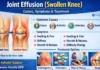 Joint Effusion (Swollen Joint) showing water on the knee with causes and treatment for knee effusion